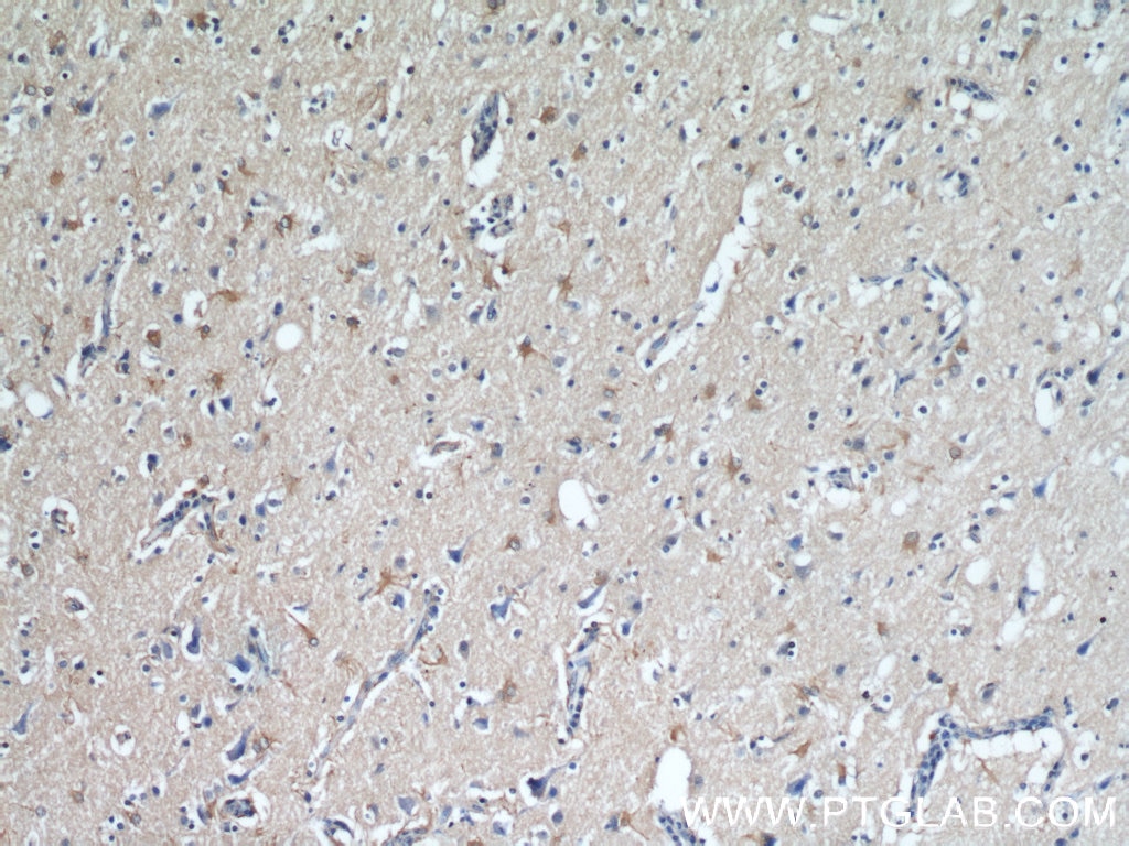 IHC staining of human brain using 55491-1-AP