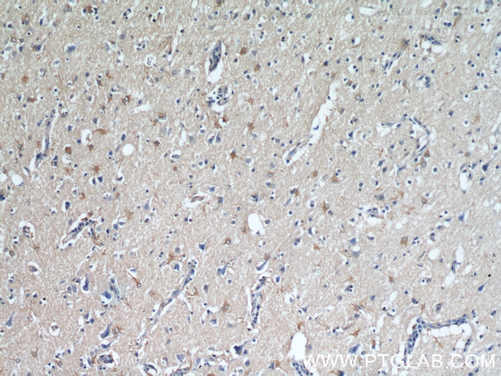 Immunohistochemistry (IHC) staining of human brain tissue using VGLUT1 Polyclonal antibody (55491-1-AP)