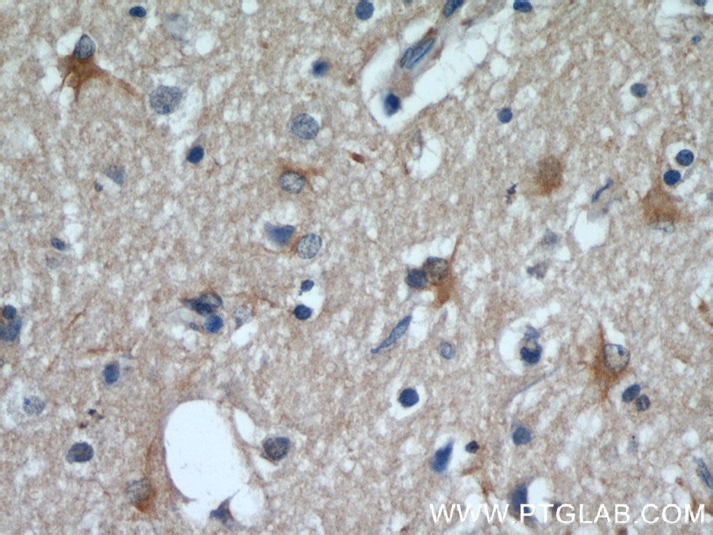 Immunohistochemistry (IHC) staining of human brain tissue using VGLUT1 Polyclonal antibody (55491-1-AP)