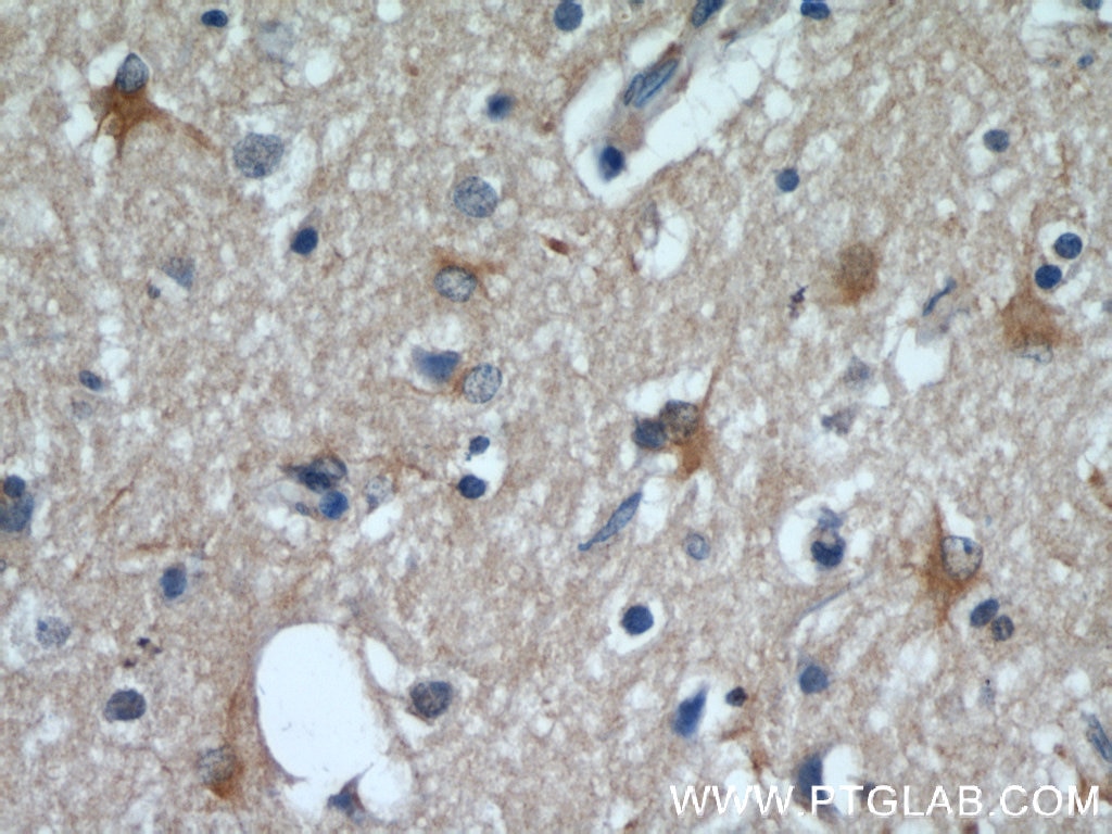 IHC staining of human brain using 55491-1-AP