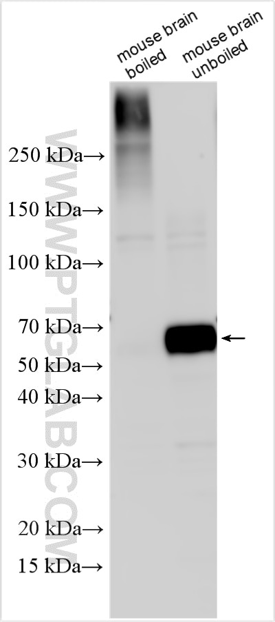 Western Blot (WB) analysis of various lysates using VGLUT1 Polyclonal antibody (55491-1-AP)
