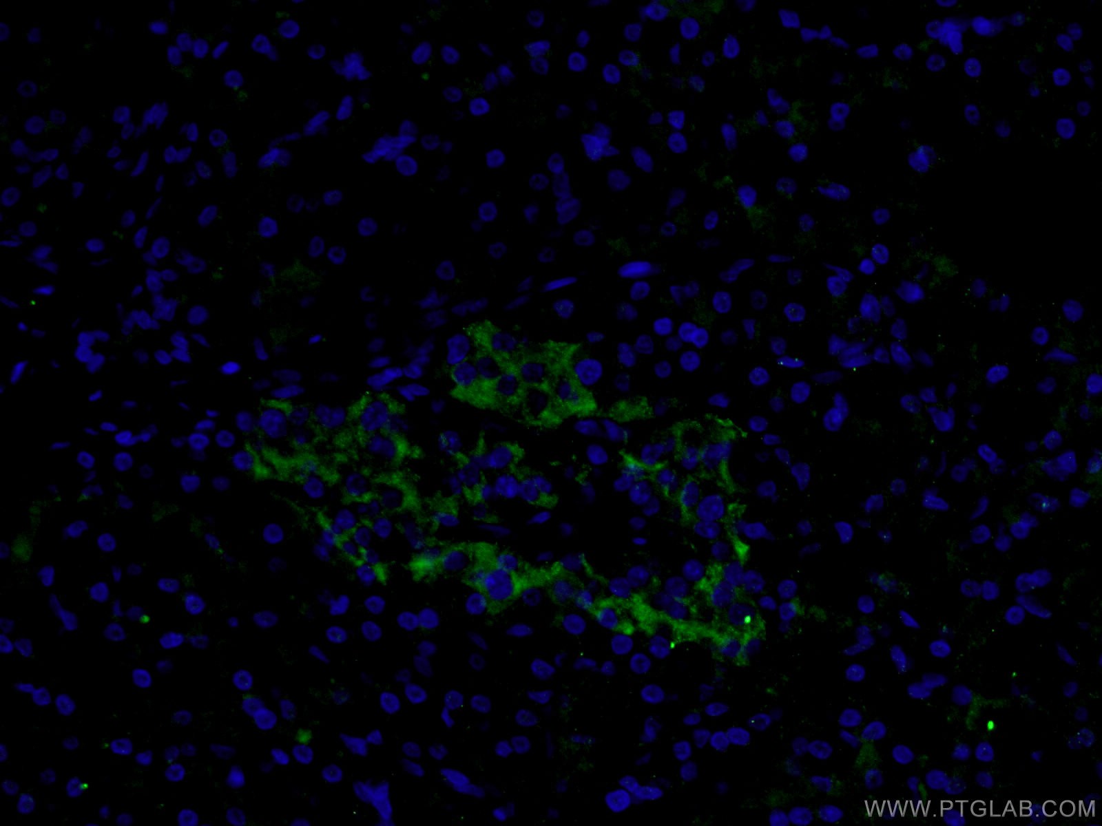 Immunofluorescence (IF) / fluorescent staining of human pancreas tissue using SLC17A9 Polyclonal antibody (26731-1-AP)
