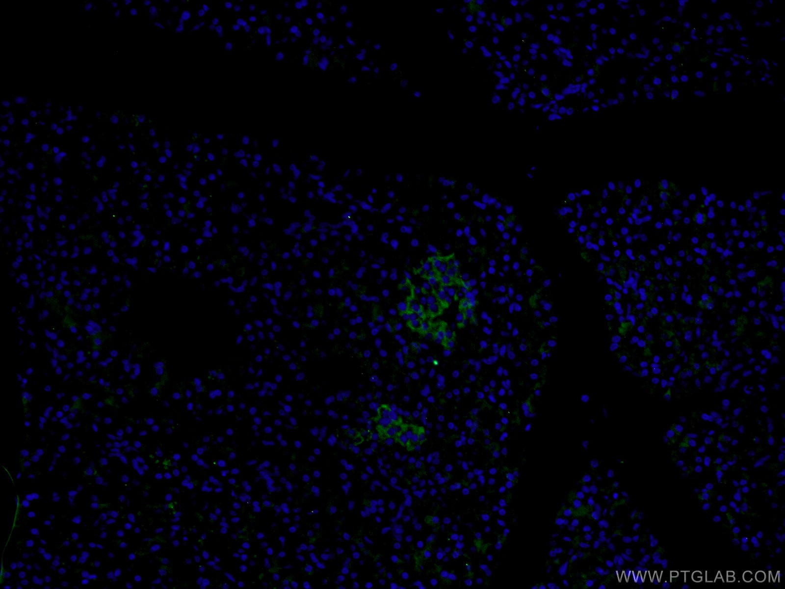 Immunofluorescence (IF) / fluorescent staining of human pancreas tissue using SLC17A9 Polyclonal antibody (26731-1-AP)