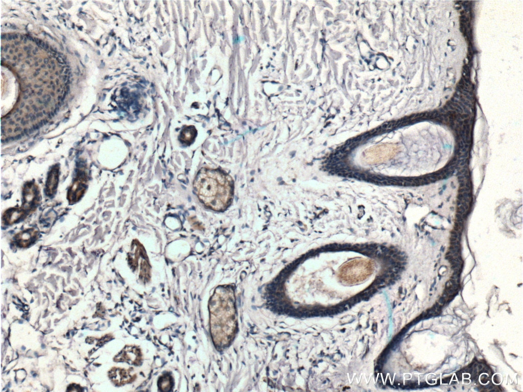 Immunohistochemistry (IHC) staining of human skin tissue using SLC17A9 Polyclonal antibody (26731-1-AP)