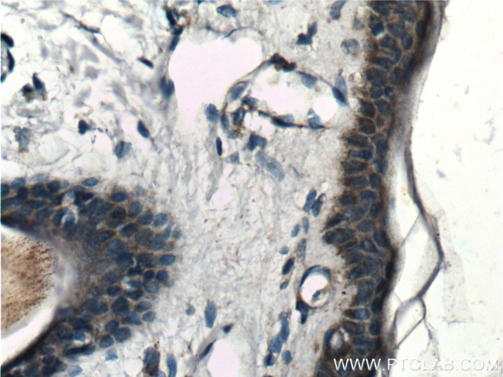 Immunohistochemistry (IHC) staining of human skin tissue using SLC17A9 Polyclonal antibody (26731-1-AP)