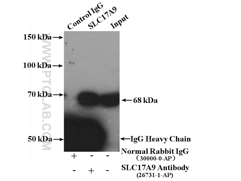 Immunoprecipitation (IP) experiment of mouse brain tissue using SLC17A9 Polyclonal antibody (26731-1-AP)