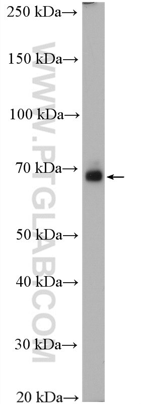 SLC17A9