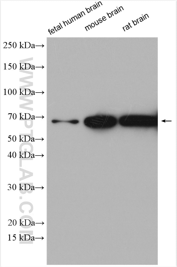 Western Blot (WB) analysis of various lysates using SLC17A9 Polyclonal antibody (26731-1-AP)