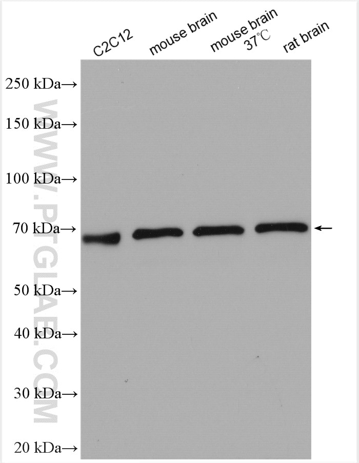 Western Blot (WB) analysis of various lysates using SLC17A9 Polyclonal antibody (26731-1-AP)