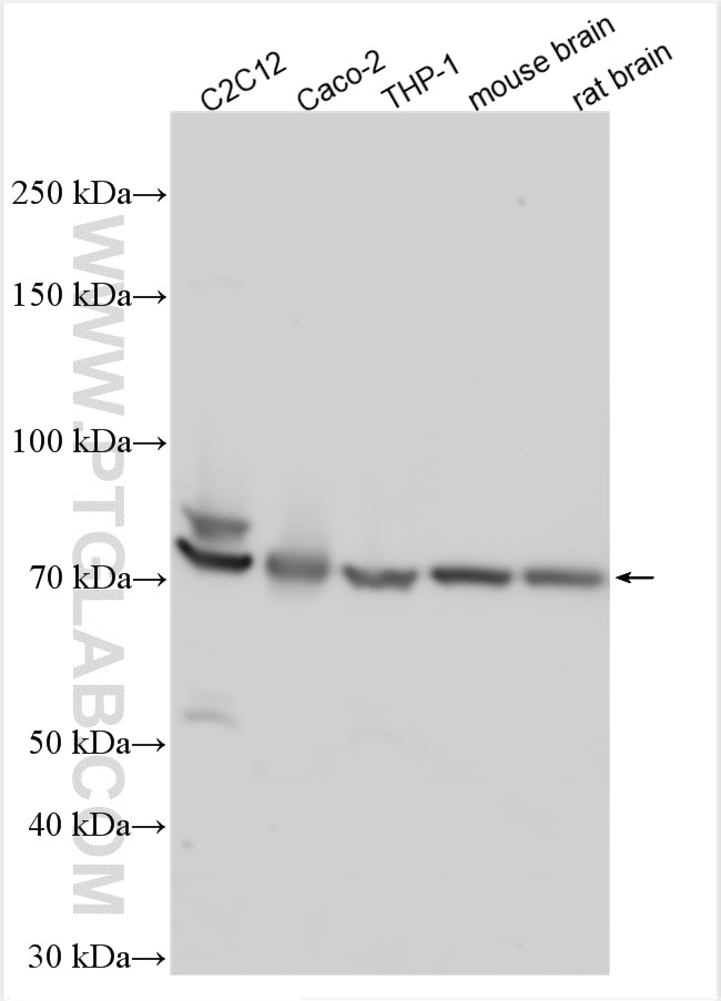 Western Blot (WB) analysis of various lysates using SLC17A9 Polyclonal antibody (26731-1-AP)