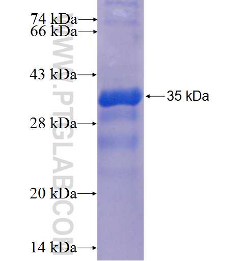 SLC17A9 fusion protein Ag24970 SDS-PAGE