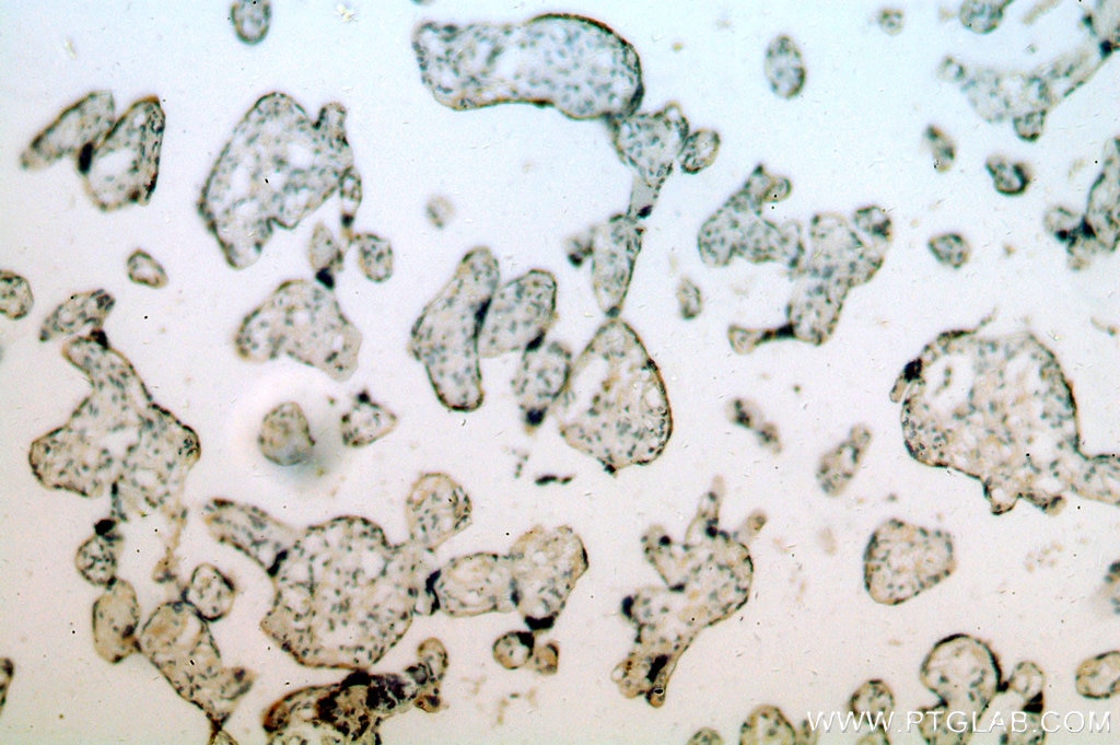 Immunohistochemistry (IHC) staining of human placenta tissue using SLC18A1 Polyclonal antibody (20340-1-AP)