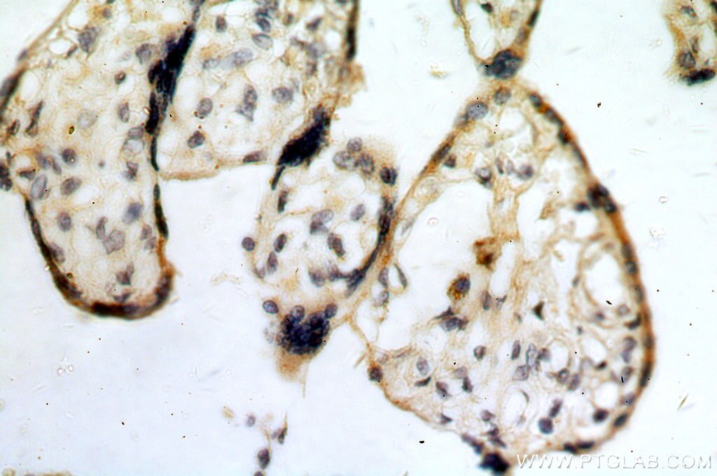 Immunohistochemistry (IHC) staining of human placenta tissue using SLC18A1 Polyclonal antibody (20340-1-AP)