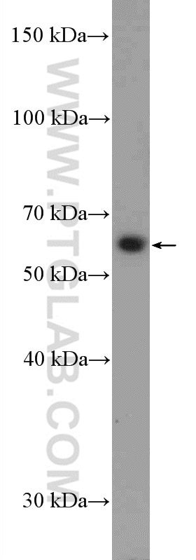 Western Blot (WB) analysis of C6 cells using SLC18A1 Polyclonal antibody (20340-1-AP)