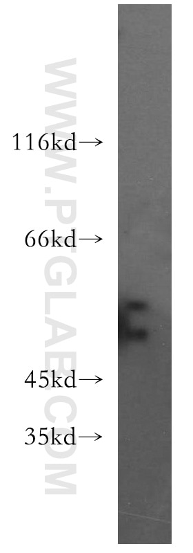 Western Blot (WB) analysis of HeLa cells using SLC18A1 Polyclonal antibody (20340-1-AP)