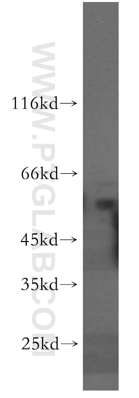 Western Blot (WB) analysis of HepG2 cells using SLC18A1 Polyclonal antibody (20340-1-AP)