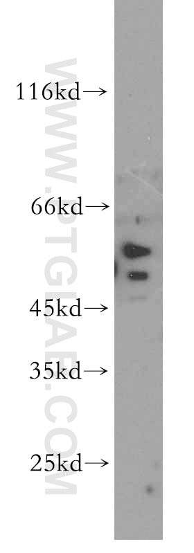 Western Blot (WB) analysis of HEK-293 cells using SLC18A1 Polyclonal antibody (20340-1-AP)