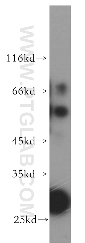 Western Blot (WB) analysis of A549 cells using SLC18A1 Polyclonal antibody (20340-1-AP)
