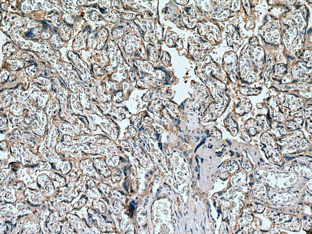 Immunohistochemistry (IHC) staining of human placenta tissue using SLC19A1 Polyclonal antibody (25958-1-AP)