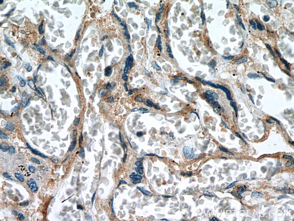 Immunohistochemistry (IHC) staining of human placenta tissue using SLC19A1 Polyclonal antibody (25958-1-AP)