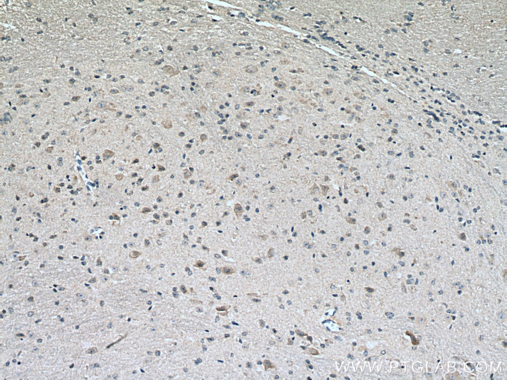 IHC staining of mouse cerebellum using 25958-1-AP