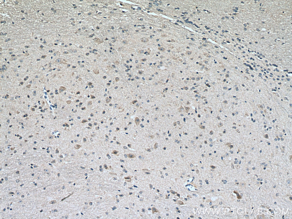 Immunohistochemistry (IHC) staining of mouse cerebellum tissue using SLC19A1 Polyclonal antibody (25958-1-AP)