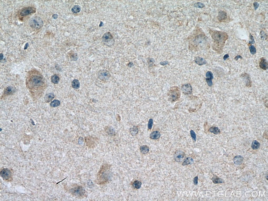 Immunohistochemistry (IHC) staining of mouse cerebellum tissue using SLC19A1 Polyclonal antibody (25958-1-AP)