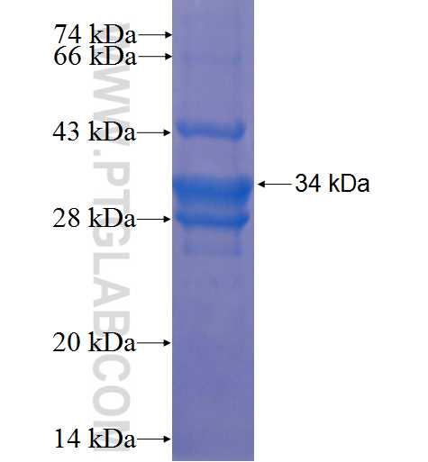 SLC19A1 fusion protein Ag22921 SDS-PAGE
