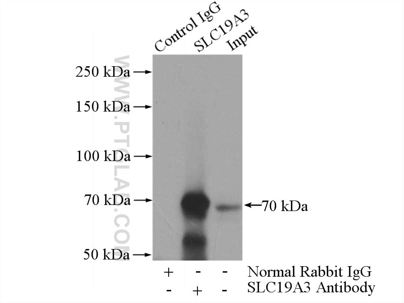 Immunoprecipitation (IP) experiment of mouse liver tissue using SLC19A3 Polyclonal antibody (13407-1-AP)