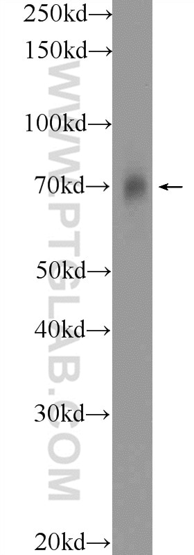 Western Blot (WB) analysis of human placenta tissue using SLC19A3 Polyclonal antibody (13407-1-AP)