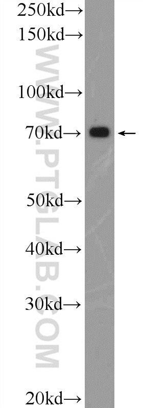 Western Blot (WB) analysis of rat heart tissue using SLC19A3 Polyclonal antibody (13407-1-AP)