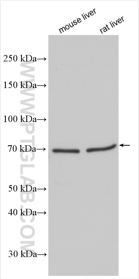 Western Blot (WB) analysis of various lysates using SLC19A3 Polyclonal antibody (13407-1-AP)