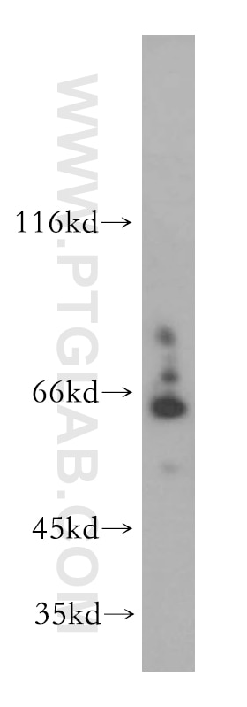 Western Blot (WB) analysis of SH-SY5Y cells using SLC19A3 Polyclonal antibody (13407-1-AP)