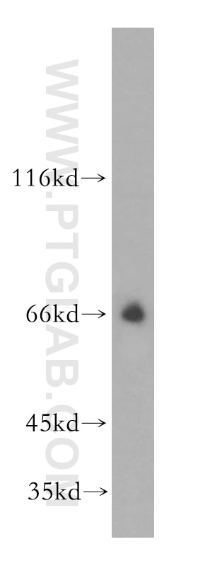 Western Blot (WB) analysis of mouse skeletal muscle tissue using SLC19A3 Polyclonal antibody (13407-1-AP)