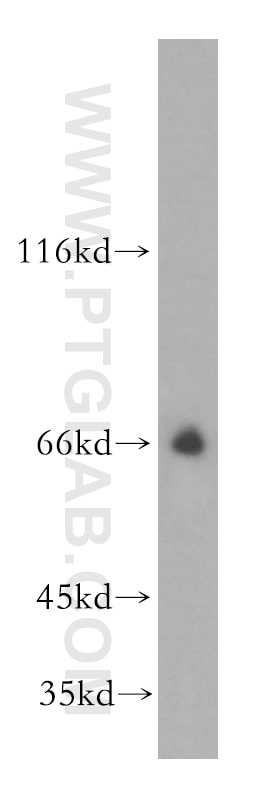 WB analysis of mouse skeletal muscle using 13407-1-AP