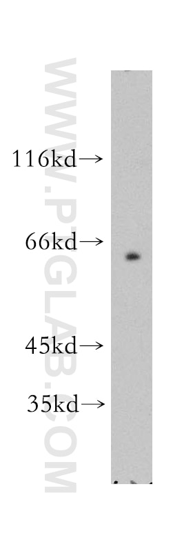 Western Blot (WB) analysis of mouse kidney tissue using SLC19A3 Polyclonal antibody (13407-1-AP)
