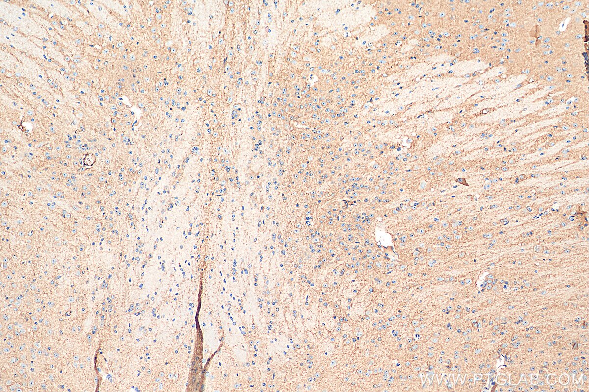 Immunohistochemistry (IHC) staining of mouse brain tissue using EAAT3 Polyclonal antibody (12686-1-AP)