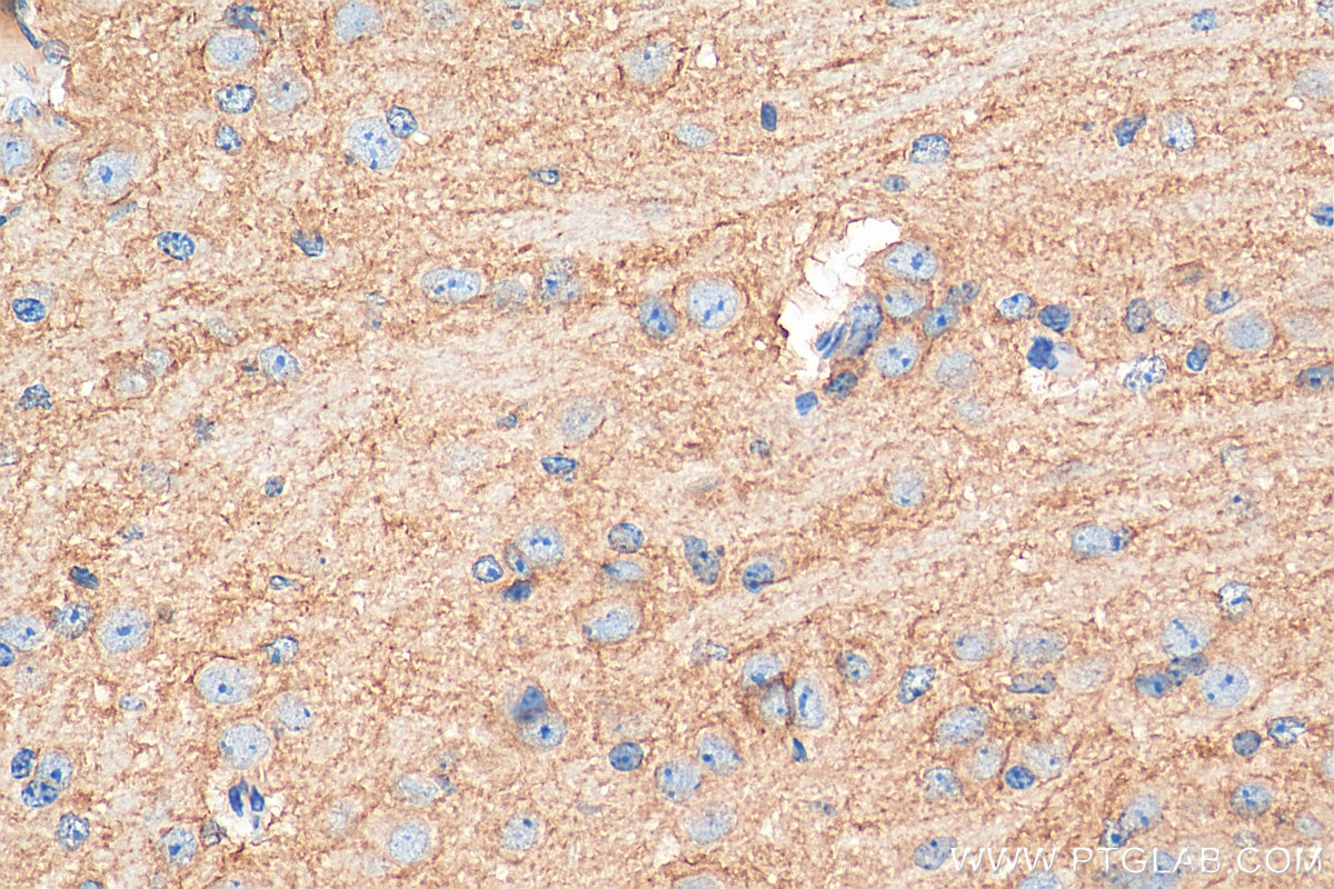 Immunohistochemistry (IHC) staining of mouse brain tissue using EAAT3 Polyclonal antibody (12686-1-AP)