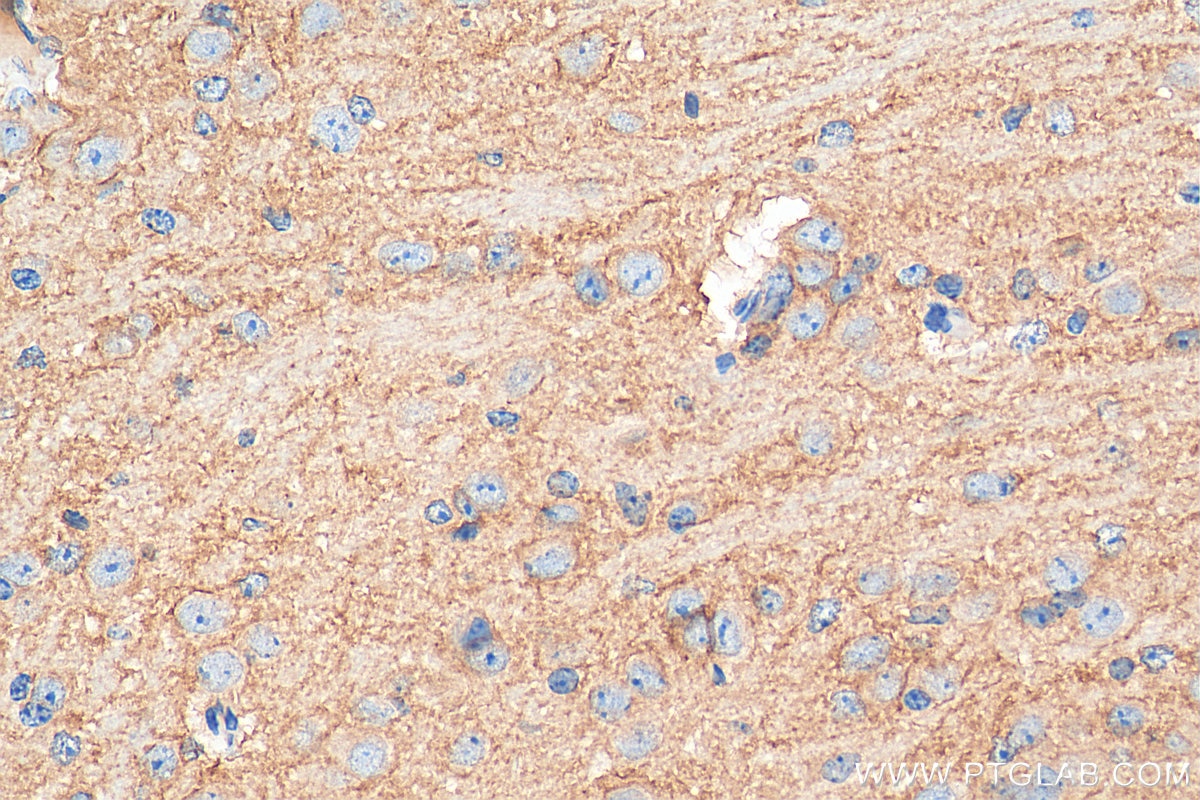 IHC staining of mouse brain using 12686-1-AP