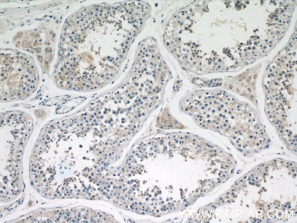 Immunohistochemistry (IHC) staining of human testis tissue using EAAT3 Polyclonal antibody (12686-1-AP)