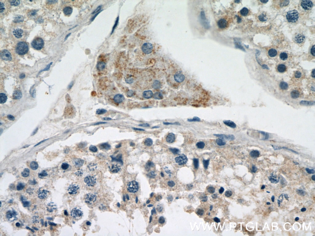 Immunohistochemistry (IHC) staining of human testis tissue using EAAT3 Polyclonal antibody (12686-1-AP)