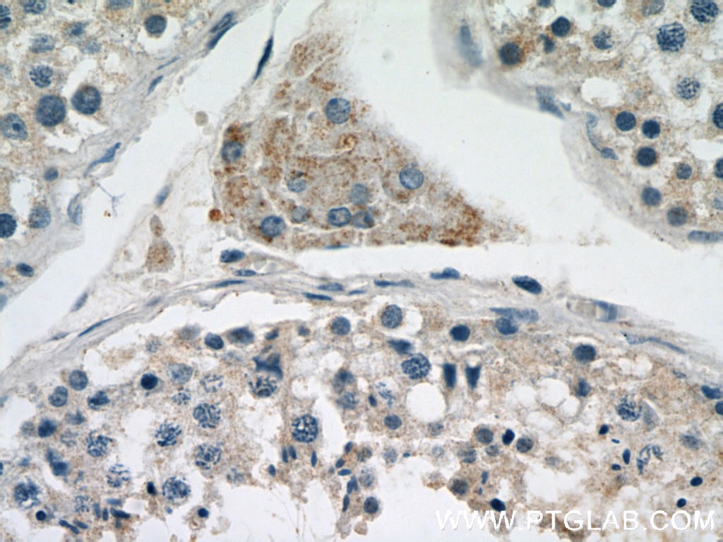 IHC staining of human testis using 12686-1-AP