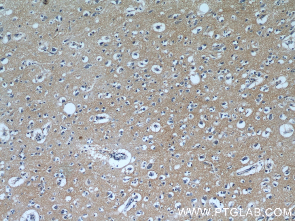 IHC staining of human brain using 12686-1-AP