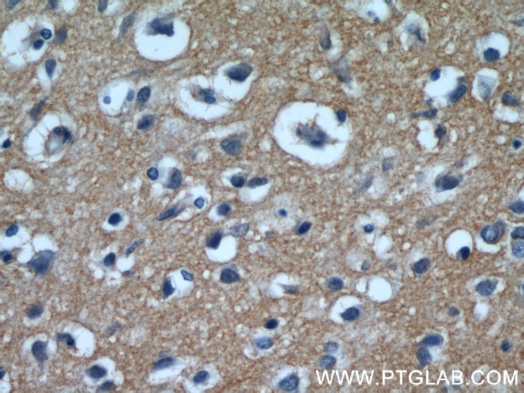Immunohistochemistry (IHC) staining of human brain tissue using EAAT3 Polyclonal antibody (12686-1-AP)