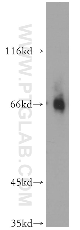 Western Blot (WB) analysis of mouse ovary tissue using EAAT3 Polyclonal antibody (12686-1-AP)