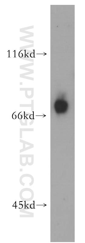 Western Blot (WB) analysis of mouse ovary tissue using EAAT3 Polyclonal antibody (12686-1-AP)