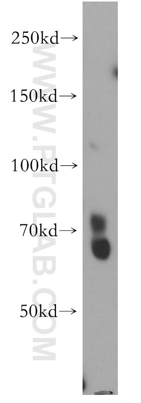 Western Blot (WB) analysis of human brain tissue using EAAT3 Polyclonal antibody (12686-1-AP)