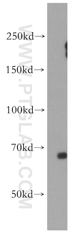 Western Blot (WB) analysis of mouse testis tissue using EAAT3 Polyclonal antibody (12686-1-AP)