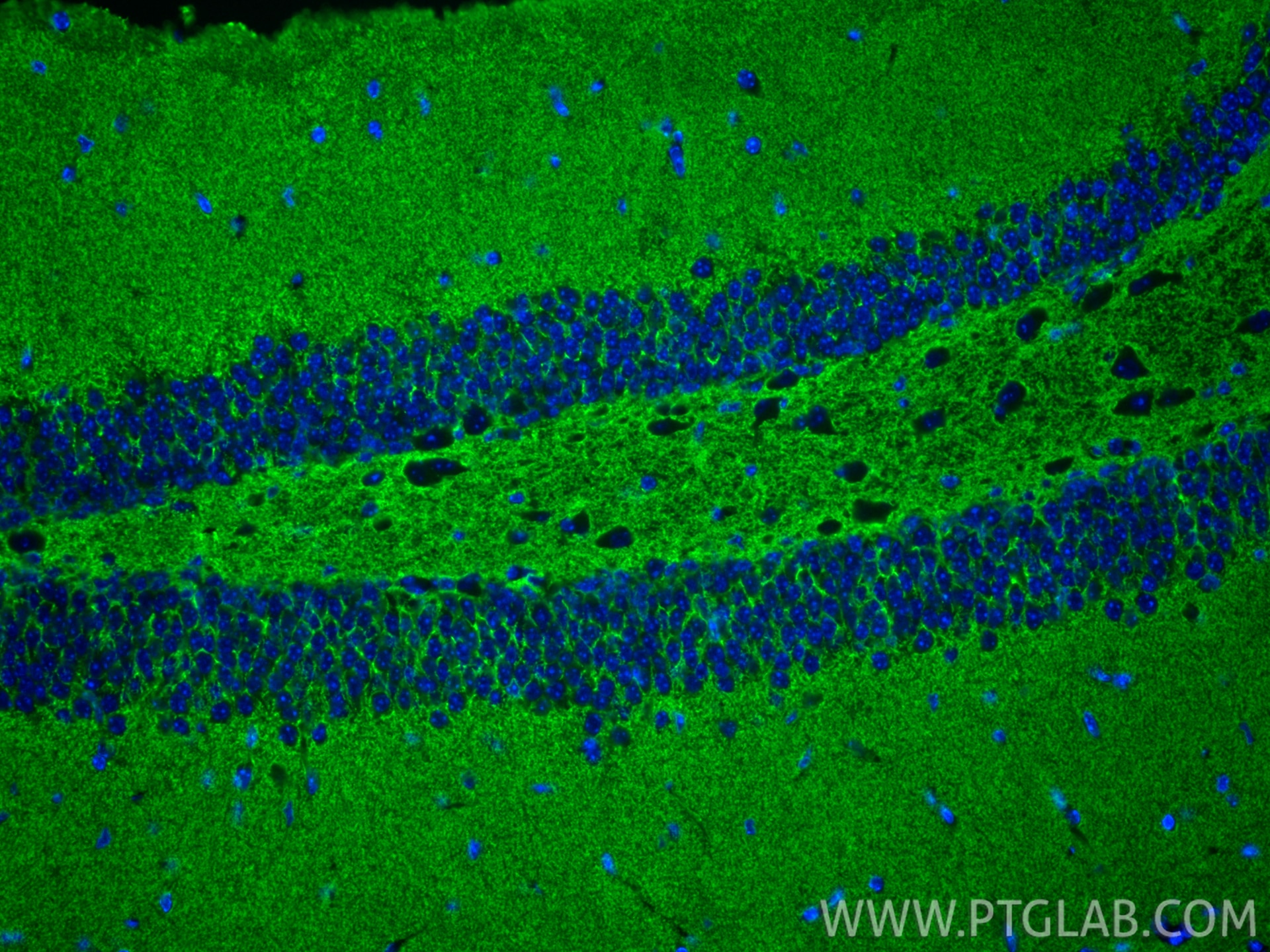 Immunofluorescent analysis of (4% PFA) fixed paraffin-embedded mouse brain tissue using EAAT2 antibody (22515-1-AP) at dilution of 1:200 and CoraLite®488-Conjugated Goat Anti-Rabbit IgG(H+L) (SA00013-2). Heat mediated antigen retrieval with Tris-EDTA buffer (pH 9.0). Immunofluorescence (IF) / fluorescent staining of mouse brain tissue using EAAT2 Polyclonal antibody (22515-1-AP)