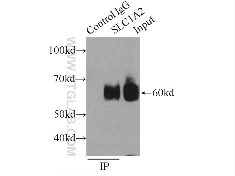 IP experiment of mouse brain using 22515-1-AP